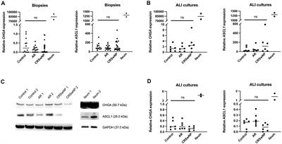 Rare presence and function of neuroendocrine cells in the nasal mucosa